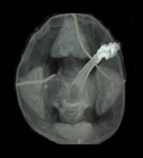 India’s deep seas are home to 4,371 species of fauna, reveals ZSI