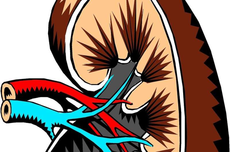 Study shows climate change will lead to increase in kidney stones