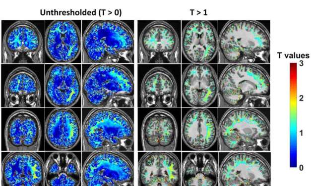 Shedding light on alcohol’s impact on brain activity in social drinkers