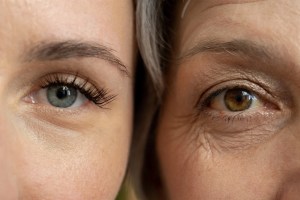 Can your diet slow skin aging? New review reveals what helps and what harms 1