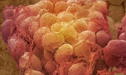 Weight loss may ‘rejuvenate’ fat tissues, clearing away aged cells