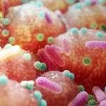 Parkinson’s Link to Gut Bacteria Suggests Unexpectedly Simple Treatment