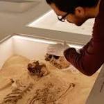 Ice Age girl reveals earliest known genetic disorder