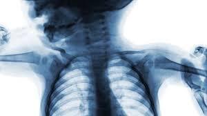 Why Are Human Babies Born With More Bones Than Adults? Hint: Evolution Left Us Unfinished On Purpose  